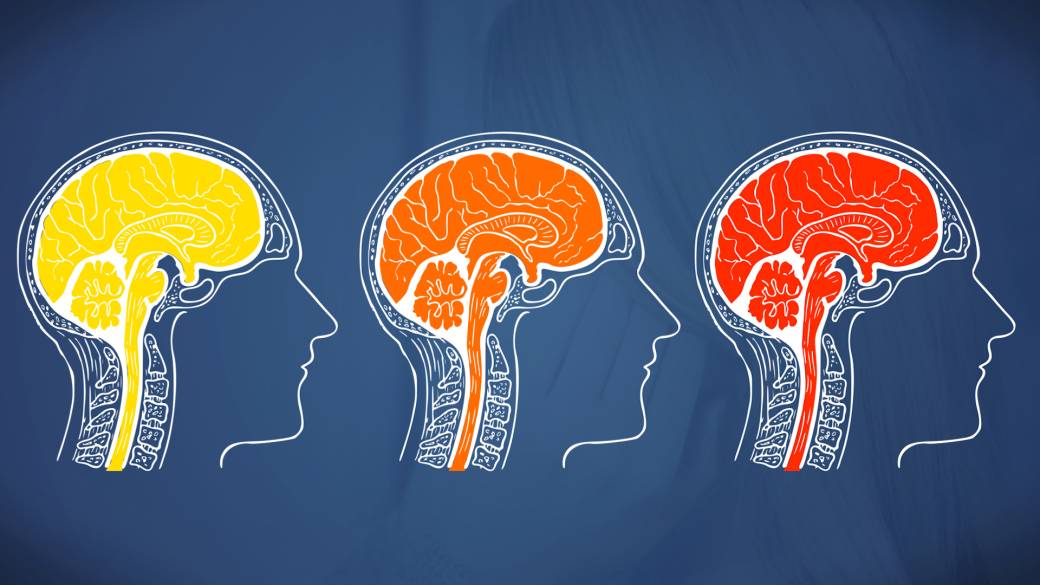 Migren ve Baş Ağrıları Arasındaki Fark Nedir?